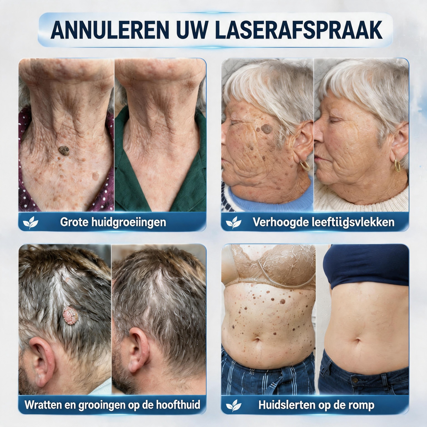 Natravor® Geavanceerde Corrigerende Crème voor Huidflapjes, Moedervlekken & Vlekken – 7 Dagen Zonder Pijn & Zonder Littekens – Geavanceerde Verzorging voor Huidoneffenheden