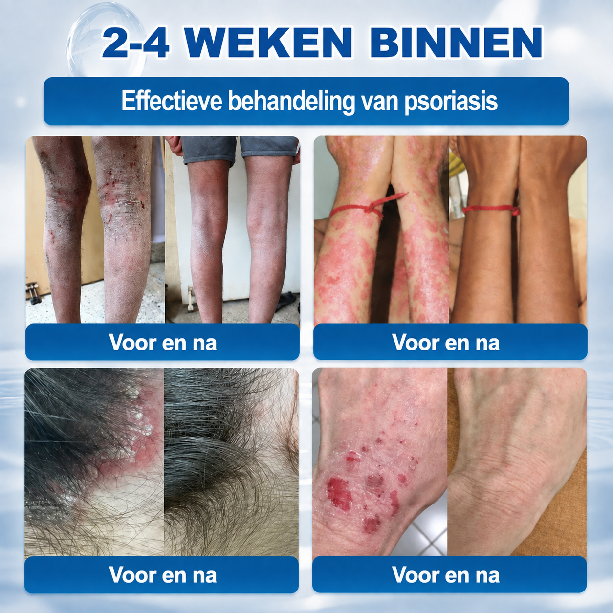 Natravor® Geavanceerde Corrigerende Crème voor Huidflapjes, Moedervlekken & Vlekken – 7 Dagen Zonder Pijn & Zonder Littekens – Geavanceerde Verzorging voor Huidoneffenheden